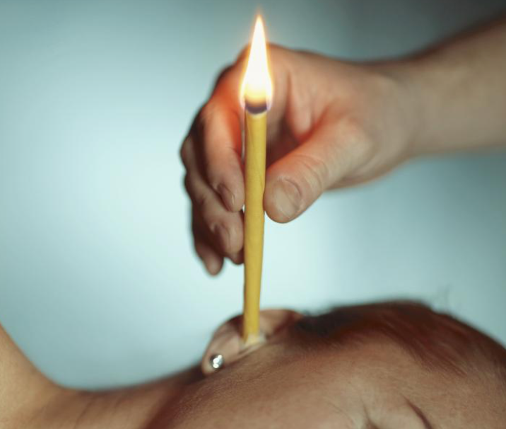 Is Ear Candling Safe & Effective?